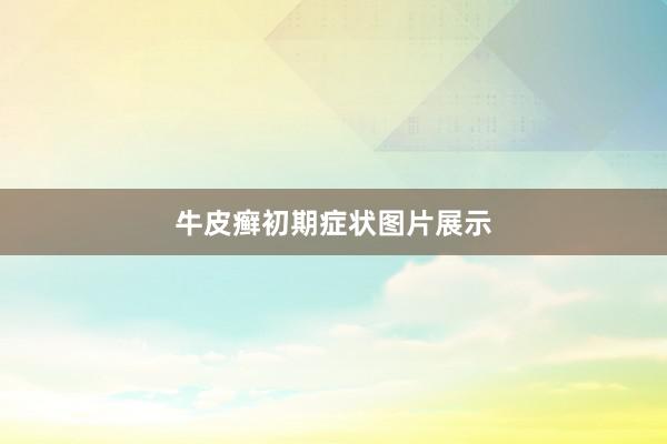 牛皮癣初期症状图片展示